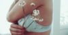 what is breast implant illness syndrome