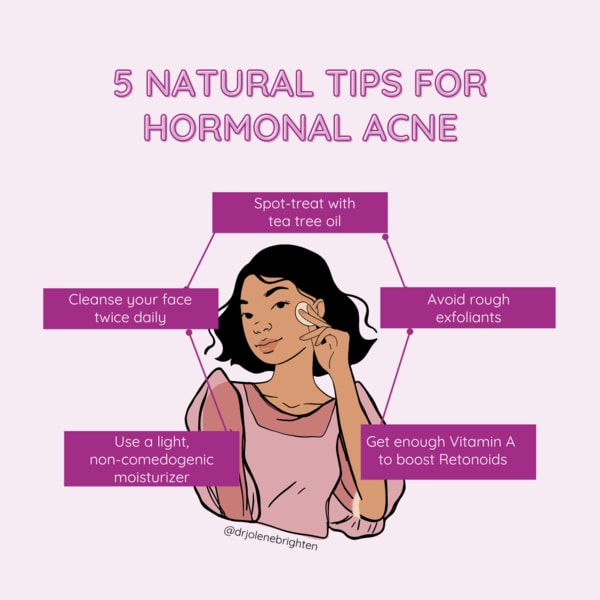 tips for hormonal acne