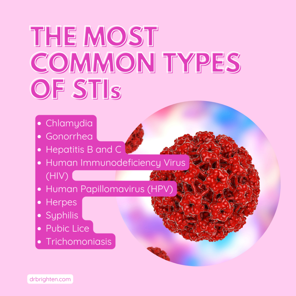 common types of stis