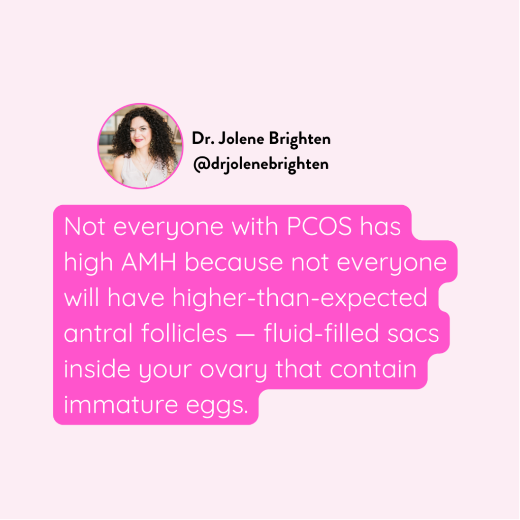 PCOS and high AMH Levels