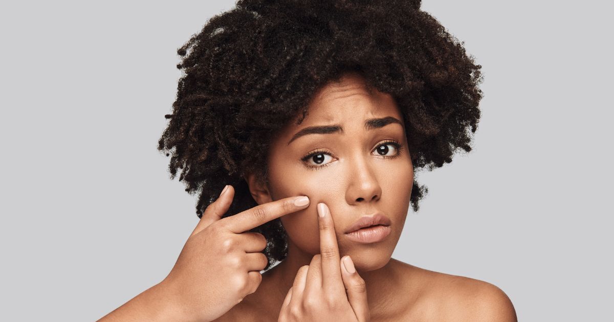 acne and polycystic ovary syndrome