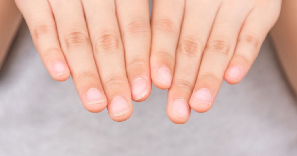 no half moon nails