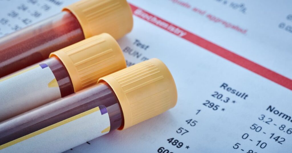 blood test sex hormone binding globulin