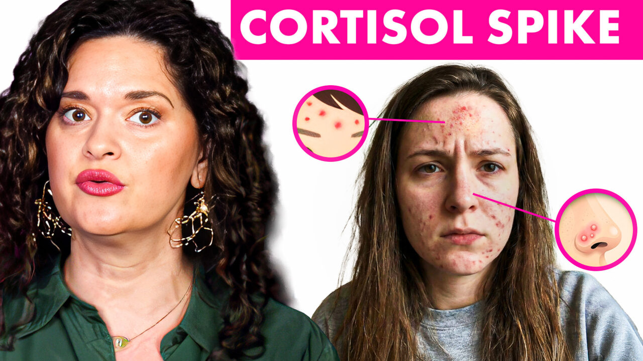 high cortisol