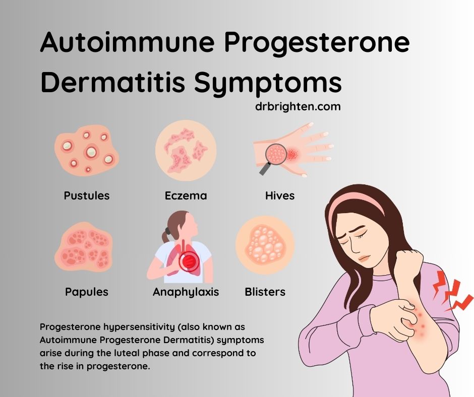 can glutathione cause allergy Why a Detox Diet a Rash  and What to Do if It Happens 10 Glutathione Injection Side Effects