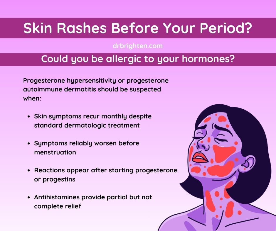 can glutathione cause hives Stop the Scratching: Solutions to Manage Drug Allergy Rash Can Vitamins Cause Hives or
